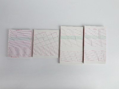 醫(yī)療記錄紙安裝及注意事項(xiàng)有哪些